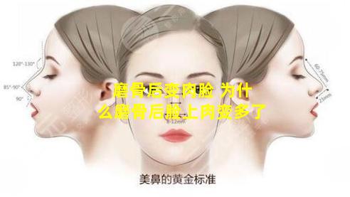磨骨后变肉脸 为什么磨骨后脸上肉变多了